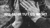 영상 썸네일 Wie sehr tut es weh?