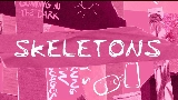 영상 썸네일 Skeletons